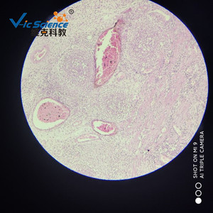 Typhoid fever, medical histology, digestive system diseases, animal and plant slides, <b>microscope</b> use. - Product Image 3