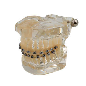 Modelo de Ortodoncia Typodont para Educación Dental con Brackets Metálicos y 28 Piezas Dentales - Product Image 5