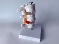 Modelo de Hernia Discal Lumbar Humana con Vértebras Desmontables para Quiroprácticos, Modelo de Columna Espinal de 3 Vértebras, CE/ISO