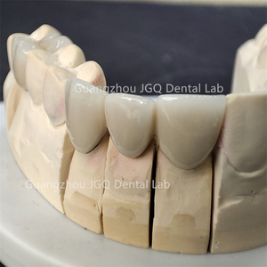 Laboratoire dentaire professionnel fabrication Pfz zircone couronnes dents molaires esthétique <span class=keywords><strong>prix</strong></span> abordable - Product Image 5