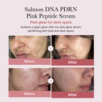 OEM/ODM Marque Privée Vente en Gros ADN de Saumon PDRN Peptide Rose pour Essence Sérum de Soin à la Niacinamide pour Hydratation et Soin de la Peau