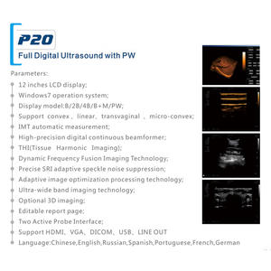 Appareil d'échographie numérique complet P20 avec écran LCD de 12 pouces et PW pour diagnostic vétérinaire - Product Image 1