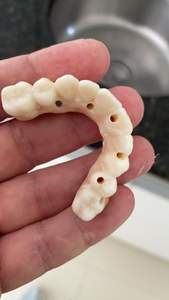 Cerámica de Óxido de Zirconio (Zirconia) Amann para Coronas Anteriores, Puentes, Pilares y Abutments, Resistencia de 1200Mpa, Compatible con Sistemas AG - Product Image 6