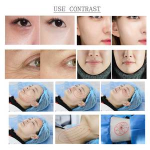 Hot bán nhăn loại bỏ da thắt chặt vẻ đẹp thiết bị kích thích collagen tăng chống lão hóa máy mặt Nâng máy - Product Image 6