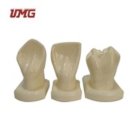Modelos Dentales y de Guía para Tallado de Dientes