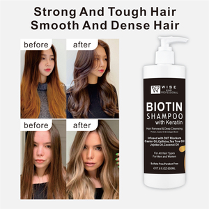 Biotin Shampoo Keratin 500ml Großhandel Haar erneuerung Tiefen reinigungs protein Alle Haare Typ Anti-Schuppen <span class=keywords><strong>Bio</strong></span> Pflanzen Shampoo - Product Image 3