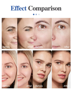 وجه احترافي آلة li f t W <span class=keywords><strong>r</strong></span> i n k L e <span class=keywords><strong>s</strong></span> <span class=keywords><strong>R</strong></span> e m o v a l 7 في 1 مدلك الوجه الكهربائي الغلفاني آلة صغيرة - Product Image 4