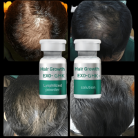 2billion Exos GHK-Cu Polvo Liofilizado para el Crecimiento del Cabello, Solución Profesional Anticaída, Estimulación de Folículos, Tratamiento de Regeneración