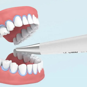 Polisseur dentaire à air haute pression à bon prix avec turbine/alimentation électrique pour prophy dentaire et détartrage supragingival - Product Image 5