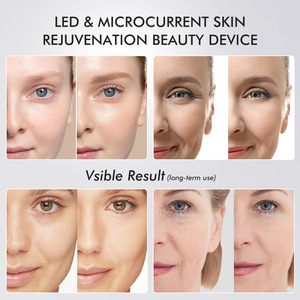 5-Color <b>LED</b> Facial Beauty Pen with Red Blue Green Orange Purple <b>Light</b> for Anti-Aging and Skin Rejuvenation - Product Image 4