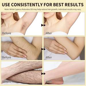 Huile de Cyperus Rotundus naturelle pour réduire la repousse des poils corporels, pour l'élimination des poils incarnés, réduit la repousse des poils indésirables, resserre les pores - Product Image 4