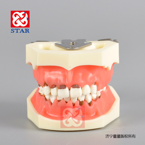 Periodontal प्रशिक्षण मॉडल नकली periodontal प्रक्रियाओं स्केलिंग probing हटाने योग्य दांत और मसूड़ों - Product Image 2