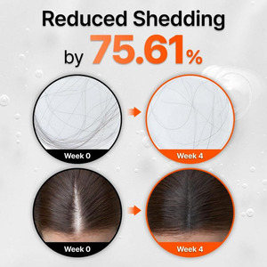 Aceite Esencial para el Cuidado del Cabello OEM, Fortalece el Cabello, Minimiza la Rotura, Estimula los Folículos, Suaviza y Nutre el Cabello Seco - Product Image 4