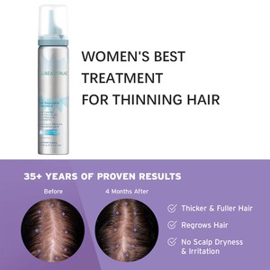 Traitement capillaire quotidien topique en mousse pour femmes contre la <span class=keywords><strong>chute</strong></span> des <span class=keywords><strong>cheveux</strong></span>, pour une repousse plus dense et plus épaisse, huile capillaire non parfumée, spray <span class=keywords><strong>de</strong></span> croissance capillaire - Product Image 4