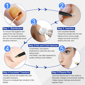 เครื่องกำจัดขนถาวรด้วยระบบอิเล็กโทรไลซิสสำหรับกำจัดขนแบบ5in1พร้อมเข็มทอง * 100 - Product Image 4