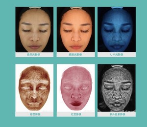 皮膚科病院用皮膚分析装置中国メーカープロ顔画像解析機 - Product Image 5
