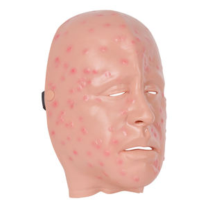 Máscara de Demostración de Lesión Facial por Viruela Leve - Product Image 4