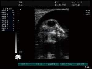 Échographe vétérinaire haute performance MC1000Vet pour le diagnostic de gestation animale, la santé de la vésicule biliaire, des reins, de la vessie et de l'<span class=keywords><strong>utérus</strong></span> - Product Image 5