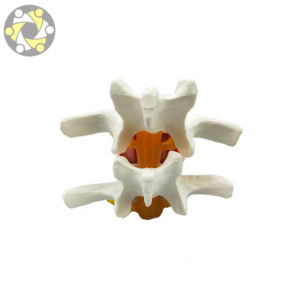 Sains medis Lumbar Disc Herniation Simulator tulang belakang Vertebral Model - Product Image 3