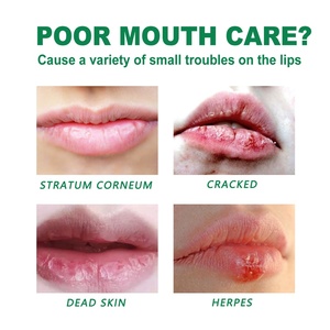 Bálsamo Labial Medicado Herbal Natural de Marca Privada Personalizada, Bálsamo Labial Nutritivo, Exfoliante, Hidratante Duradero - Product Image 6