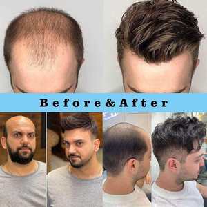 Postizo de Cabello Humano Natural Negro de 6 Pulgadas, Fácil de Usar, Aspecto Natural, Ajuste Cómodo, Ligero y de Calidad - Product Image 6