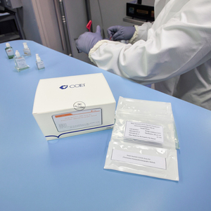 El Kit de detección rápida de amiloide en suero utiliza un método inmunocromatográfico de fluorescencia para la evaluación de respuesta de fase aguda - Product Image 1