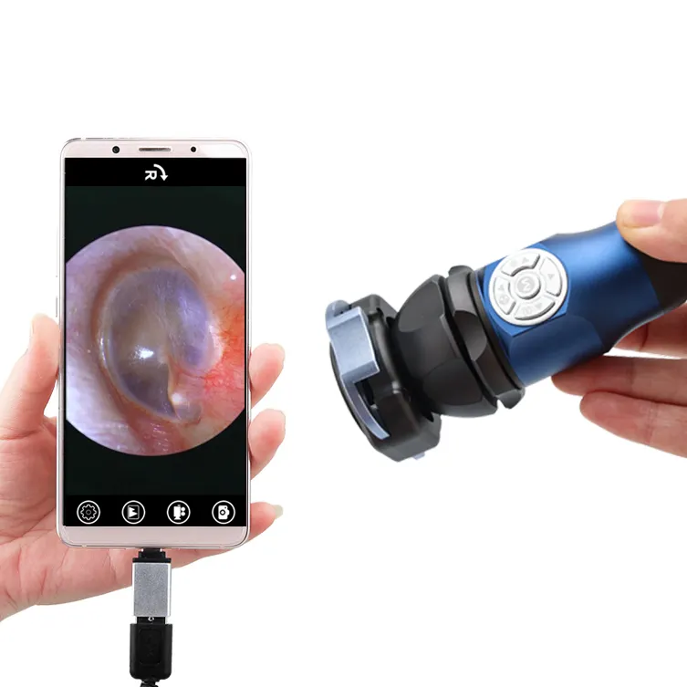 Système de caméra d'endoscope médical Caméra d'endoscopie du nez et de la gorge de l'oreille Caméra d'endoscopie portable HDMI HD 1080P USB ENT