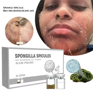 Kit Profesional <span class=keywords><strong>de</strong></span> Microagujas Bio ODM OEM 90% con <span class=keywords><strong>Peeling</strong></span> <span class=keywords><strong>Natural</strong></span> <span class=keywords><strong>de</strong></span> <span class=keywords><strong>Algas</strong></span>, Tratamiento <span class=keywords><strong>de</strong></span> Espículas <span class=keywords><strong>de</strong></span> Esponja - Product Image 1