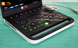 Ecógrafo <span class=keywords><strong>de</strong></span> Diseño Duradero con Imágenes <span class=keywords><strong>de</strong></span> Alta Definición SUN-800C PW para Centros <span class=keywords><strong>de</strong></span> Atención Primaria y Laboratorios <span class=keywords><strong>de</strong></span> Diagnóstico - Product Image 4