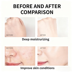 Özel etiket Nicotinamide organik yüz cilt aydınlatma Anti-aging VC nemlendirici hyaluronik asit 1KG yüz beyazlatma kremi - Product Image 4