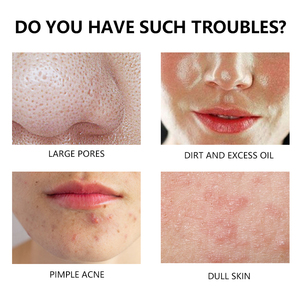 Private Label Herbal <strong>Green</strong> Tea Gel Facial Cleanser with Deep Cleansing <strong>and</strong> Pore <strong>Cleaning</strong> - Product Image 3