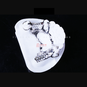 Marco metálico completo <span class=keywords><strong>superior</strong></span> e inferior con <span class=keywords><strong>dentadura</strong></span> <span class=keywords><strong>parcial</strong></span> acrílica - Product Image 2