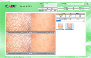 JYTOP DM331U Vérifier l'état de santé vérifier l'état physique et prévenir les maladies Iriscope Diagnostic iridologie caméra - Product Image 4
