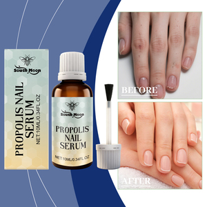 Suero <span class=keywords><strong>de</strong></span> Uñas con Propóleo, Esencia para Eliminar Hongos <span class=keywords><strong>en</strong></span> las Uñas <span class=keywords><strong>de</strong></span> los Pies, Mejora las Uñas Amarillas y Quebradizas, Tratamiento para Manos y Pies, Líquido Reparador - Product Image 2