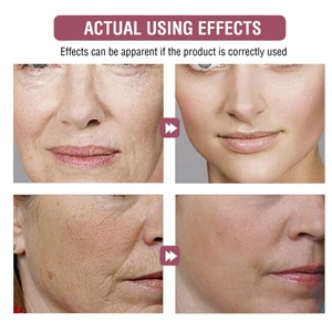 Sérum Visage Biosphère Nouvelle Beauté 5 en 1 Éclaircissant Anti-Âge Vitamine C Niacinamide Arbutine Acide Kojique Soin de la Peau - Product Image 5