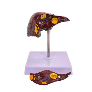Modèle de pathologie hépatique, modèle de foie gras, modèle hépatobiliaire, foie malade, modèle d'anatomie hépatique humaine simulée - Product Image 5