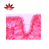 Individual human System Pathology prepared microscope slides ,human pathology slides