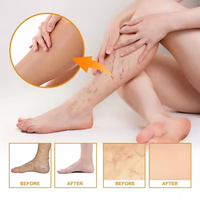 Crème Vitamine K-Formule de guérison des ecchymoses avec Arnica. Hydratant pour les taches foncées pour réparer les cernes sous les yeux et les poches.