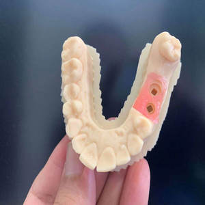 IFUN 3161 Résine dentaire <span class=keywords><strong>flexible</strong></span> pour impression 3D, rose clair, 1 kg/bouteille, 3D LCD DLP - Product Image 3