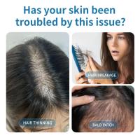 Minyak Rambut Herbal CHUSN Copper Peptide Memperkuat Akar, Mengurangi Kerontokan, Merangsang Folikel, Pertumbuhan Baru, Formula 2-IN-1 untuk Rambut Rontok
