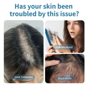 CHUSN Bitkisel Bakır Peptit Saç Yağı Kökleri Güçlendirir Kırılmayı Azaltır Folikülleri Uyarır Yeni Büyüme 2'si 1 Arada Formül Saç Dökülmesini Önler - Product Image 5