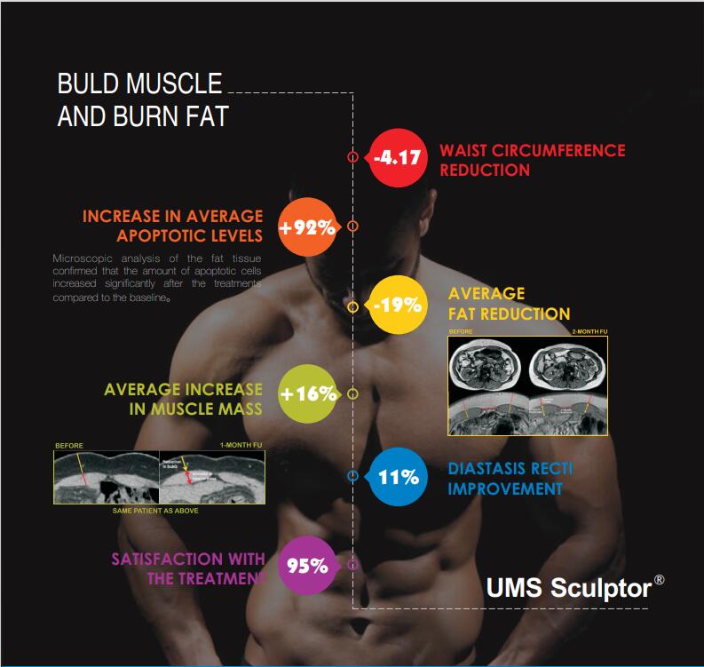 Beautiful Muscle Clinic Hi Emt Machine Ce Approved
