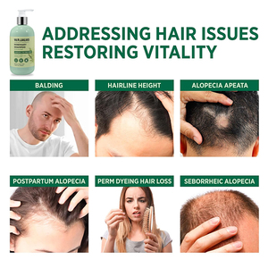 Private Label Organic Smoothing Moisturizing Natural Extension <strong>Dry</strong> Curly Care Products Hair <strong>Shampoo</strong> for All Hair Types - Product Image 3