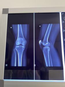 صحائف نافثة للحبر زرقاء بجودة عالية 13 بوصة * 17 بوصة لتصوير طبي صورة مستخرج بالأشعة السينية CT ، CR ، r ، MTR ، إلخ. - Product Image 3