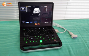 SUN-902B hot-bán y tế siêu âm DOPPLER màu siêu âm 2D Vet sử dụng máy tính xách tay usg máy siêu âm - Product Image 5