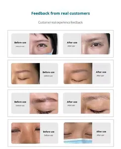 Nouveau PICO de 2e génération pour le bureau, élimination non invasive des tatouages de sourcils, sans eau, élimination des taches Ultra-Pico, blanchiment, beauté, prise US - Product Image 2