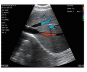 Doppler nirkabel 3 dalam 1 warna, instrumen ultrasound medis mini pendeteksi warna cembung genggam portabel Ultrasound <span class=keywords><strong>Linear</strong></span> - Product Image 4