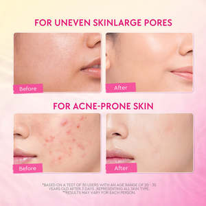 Crema Notte al Retinolo alla Pesca con Etichetta Privata per Linee Sottili e Pelle Spenta - Retinolo, HPR, Niacinamide, 100g - Product Image 3