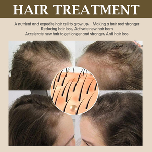 El fabricante protege el cuero cabelludo e hidrata la pérdida de reparación del cabello puntas abiertas crecimiento del cabello cuero cabelludo cabello arroz agua crecimiento Spray - Product Image 4