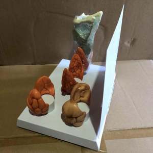 Патологическая модель щитовидной железы - Product Image 4